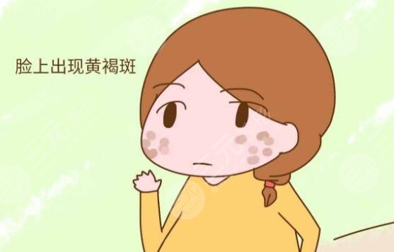 激光緩解黃褐斑注意什么?