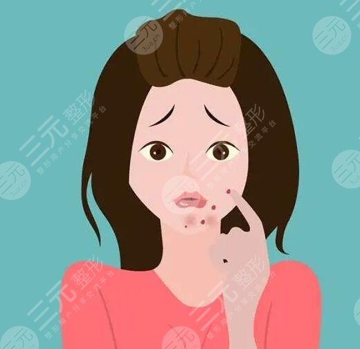 　　如何快速去青春痘?對(duì)于青春期的男生和女生們來(lái)講，大多數(shù)人都難逃青春痘的困擾，青春痘嚴(yán)重的時(shí)候會(huì)影響到一個(gè)人的顏值，所以青春期的男生和女生們大多都在戰(zhàn)“痘”，可是在緩解痘痘的時(shí)候也需要選對(duì)方法，不要盲目的去除痘痘，以免對(duì)皮膚造成傷害，下面做一個(gè)護(hù)膚達(dá)人，就來(lái)帶大家深入的認(rèn)識(shí)一下，如何快速去除青春痘?被青春痘困擾的男生女生可以詳細(xì)來(lái)了解一下。  　　1、如何快速去青春痘?  　　日常生活中快速去除青春痘的方式，常見(jiàn)的有藥物緩解、激光緩解以及紅藍(lán)光照射等，可以根據(jù)自己的皮膚狀態(tài)選擇適合自己的去除青春痘方式。  　　(1)藥物緩解  　　皮膚上的青春痘可以在專(zhuān)業(yè)醫(yī)生指導(dǎo)下，使用紅霉素軟膏或者阿達(dá)帕林凝膠進(jìn)行緩解，這些藥膏能夠快速消除青春痘。但是需要在專(zhuān)業(yè)醫(yī)生指導(dǎo)下規(guī)范用藥，不要盲目的使用，以免對(duì)皮膚造成傷害。  　　(2)激光緩解  　　激光緩解青春痘是醫(yī)療美容界的一種新型祛痘方式，激光緩解青春痘的原理，主要通過(guò)激光儀器所發(fā)出的高能熱量穿透皮膚表皮層，直接作用在皮膚基底層，這種熱量能夠促進(jìn)皮膚深層細(xì)胞組織生長(zhǎng)，從而可以讓皮膚上的青春痘逐漸修復(fù)，可以讓皮膚恢復(fù)到光滑平整的目的。  　　(3)紅藍(lán)光照射  　　紅藍(lán)光照射緩解青春痘，主要采用專(zhuān)業(yè)儀器發(fā)出的紅光熱效應(yīng)和藍(lán)光熱效應(yīng)對(duì)皮膚進(jìn)行交替照射，緩解皮膚上青春痘的同時(shí)還可以消除皮膚上的炎癥，是緩解青春痘的一種不錯(cuò)的方式。  　　2、青春痘是怎樣形成的?  　　青春痘大多是因?yàn)槊移ぶ傺装Y性病變導(dǎo)致的，因?yàn)樯眢w的內(nèi)分泌失調(diào)，導(dǎo)致雄激素水平偏高，從而誘發(fā)皮脂腺分泌增多，同時(shí)毛孔角化排出也不夠順暢，從而就形成了脂肪酸，繼發(fā)細(xì)菌感染的時(shí)候就會(huì)形成青春痘。另外在日常生活中長(zhǎng)時(shí)間喝酒，或者總是吃一些高脂肪飲食，或者是日常生活中總是長(zhǎng)時(shí)間熬夜也會(huì)導(dǎo)致青春痘生長(zhǎng)。需要注意的是青春痘并不一定是發(fā)生在青春期的，通常現(xiàn)在大多數(shù)人因?yàn)樯罟?jié)奏加快，成年人長(zhǎng)青春痘也不少見(jiàn)，并且比青春期長(zhǎng)的青春痘要比較頑固和復(fù)雜。  　　3、怎樣防止青春痘?  　　想要防止青春痘，在日常生活中要養(yǎng)成良好的飲食習(xí)慣和規(guī)律作息，平時(shí)飲食盡量少吃吃熱量比較高和脂肪含量比較高的食物，飲食可以以清淡食物為主，可以適當(dāng)?shù)亩喑砸恍┬迈r的蔬菜和水果，多喝一些溫開(kāi)水，補(bǔ)充身體所需要的維生素和微量元素，防止身體便秘。另外還要適當(dāng)?shù)募訌?qiáng)體育運(yùn)動(dòng)，讓身體適當(dāng)?shù)亩喑鲆恍┖?。除此之外要養(yǎng)成良好的規(guī)律作息，每天保持充足的睡眠，不要長(zhǎng)時(shí)間熬夜，避免有太大的精神壓力和過(guò)于抑郁的情緒。