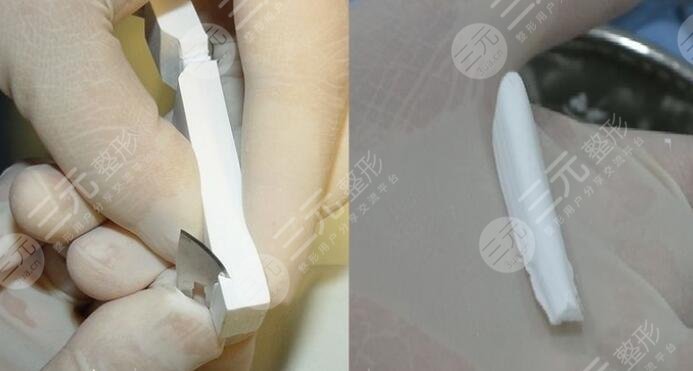 膨體材料隆鼻多少錢?