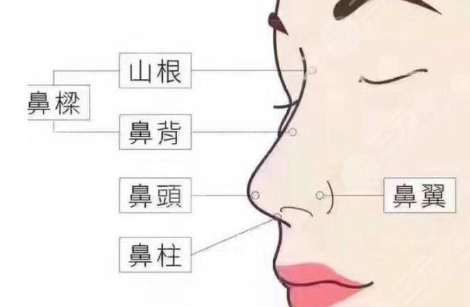 膨體隆鼻有什么優(yōu)缺點(diǎn)?