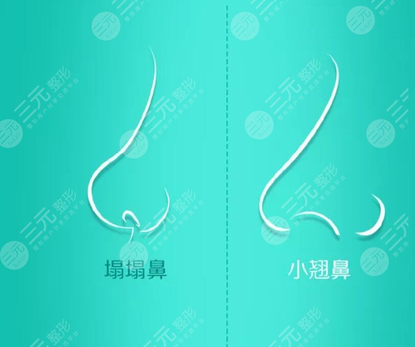 膨體隆鼻注意什么?