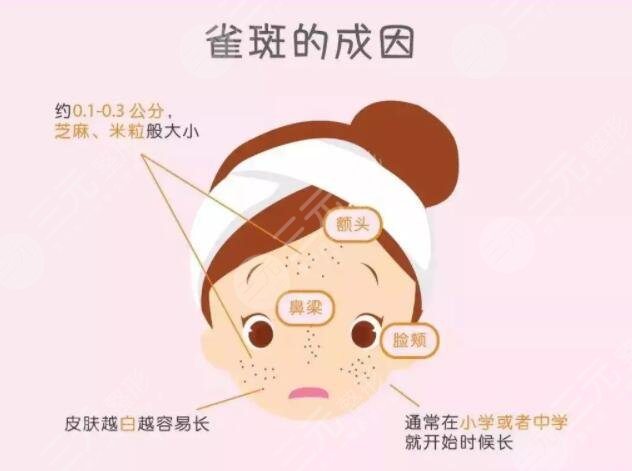 2023年彩光祛斑費(fèi)用是多少?