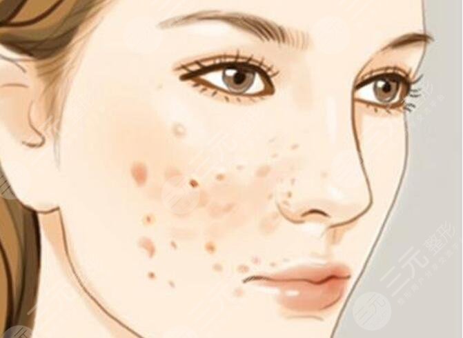 美白祛斑小竅門有哪些？看看哪些方案祛斑效果且操作簡易！輕松易上手！