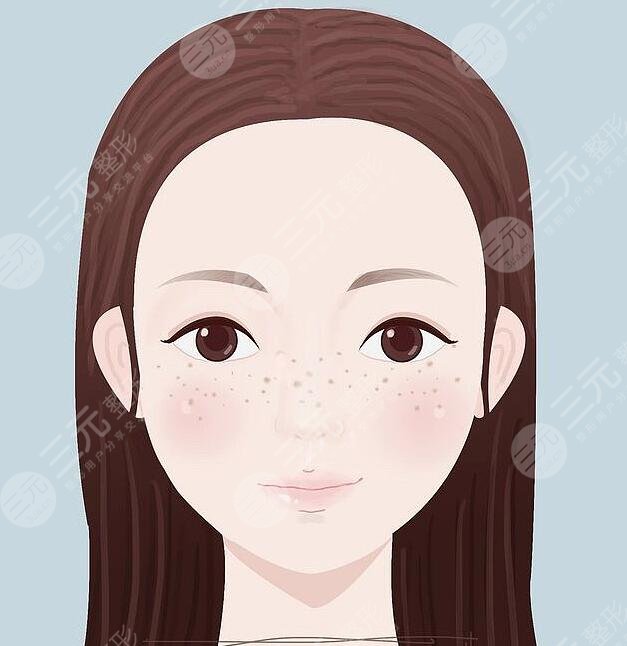 臉上長斑怎么去除有效?