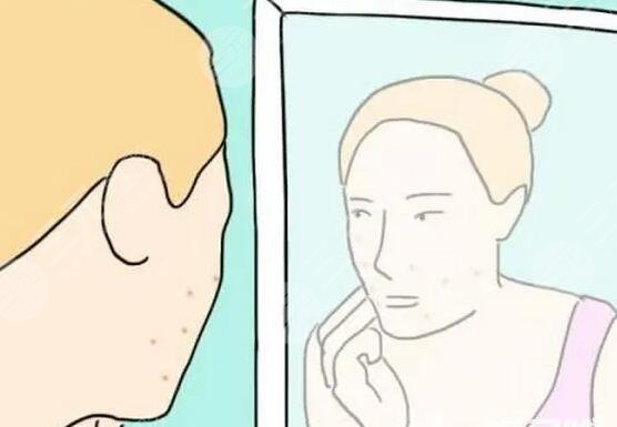 如何快速去除痤瘡見效快？找到源頭是關(guān)鍵，教你怎么做可以杜絕痤瘡反復的問題！