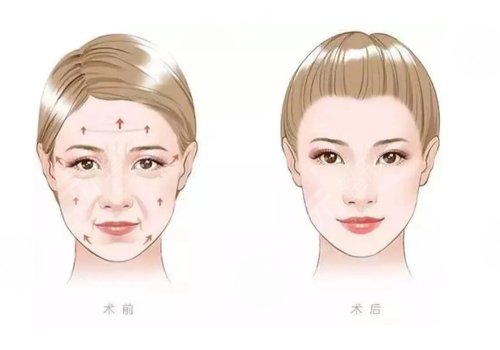 北京清木王宇面吸、填充怎么樣?