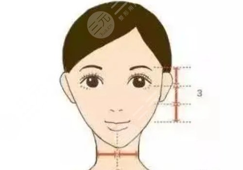 蘋果肌太大怎么改良？