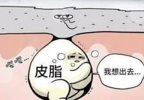 眼周圍有脂肪粒怎么引起的？