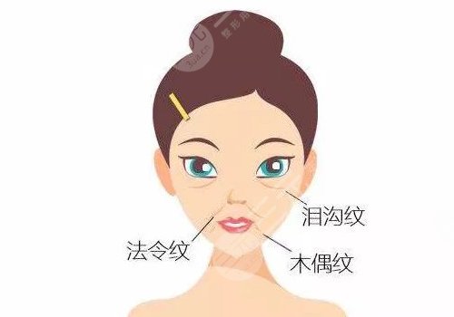 法令紋太深了有什么解決辦法？