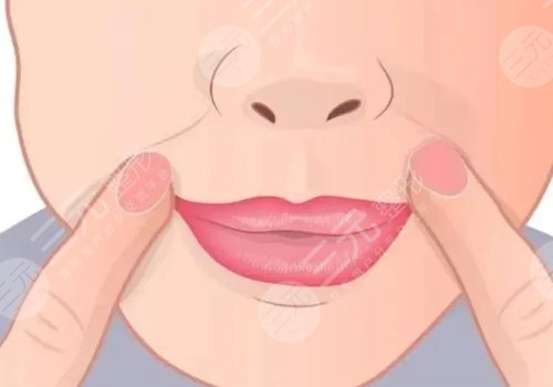 法令紋太深了有什么解決辦法？