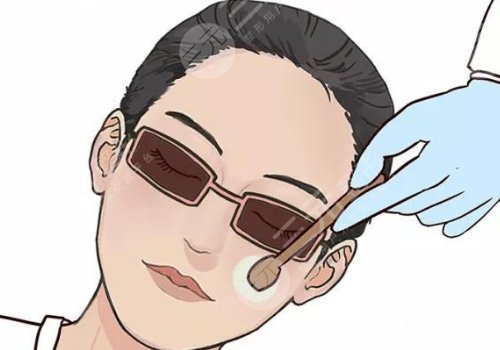 法令紋太深了有什么解決辦法？