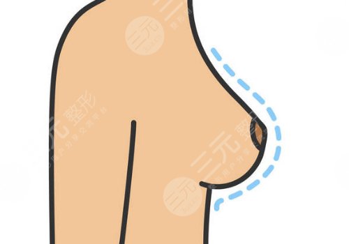 奧美定取出手術(shù)后要注意些什么？