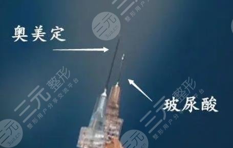 奧美定后遺癥在多久后發(fā)生?