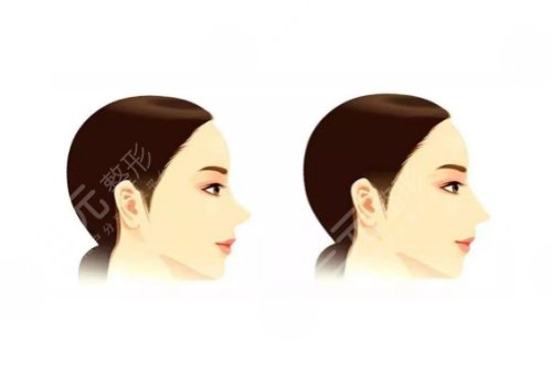 北京大學(xué)深圳醫(yī)院隆鼻坐診醫(yī)生介紹