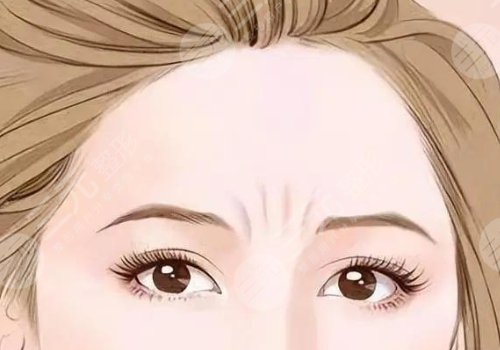 如何去除抬頭紋？