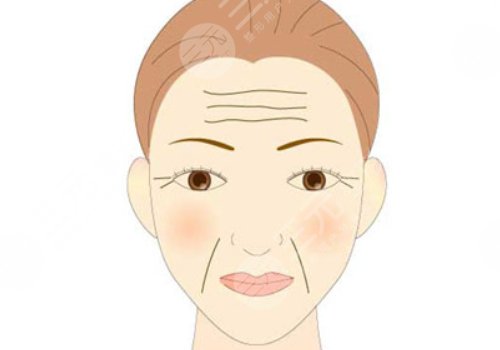 如何去除抬頭紋？