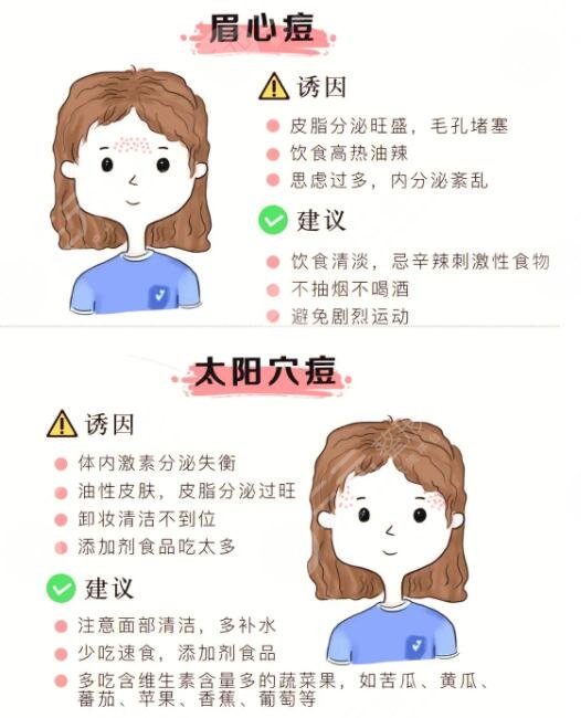 快速祛痘小竅門(mén)有哪些?