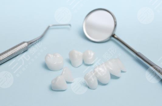 鈷鉻烤瓷牙和全瓷牙哪個(gè)好？