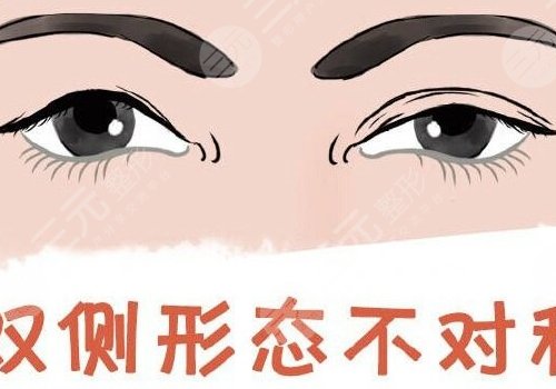 雙眼皮修復(fù)大概多少錢呢?