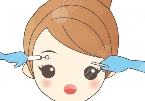 紋眉毛幾天可以恢復好？