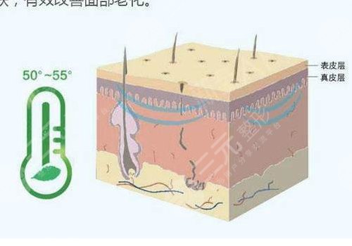 深藍(lán)射頻做一次有效果嗎？