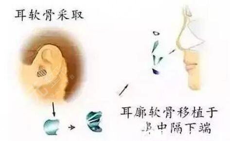 金孝憲做鼻子什么風(fēng)格？醫(yī)生個人資料、技術(shù)審美擅長、網(wǎng)友顧客點評一覽~