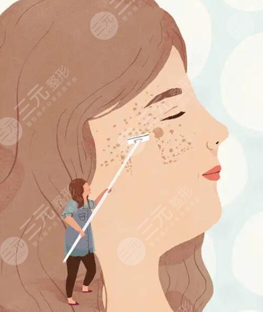 激光去色斑后還會(huì)復(fù)發(fā)嗎?