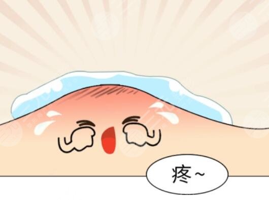 痤瘡的緩解價格是多少2023?