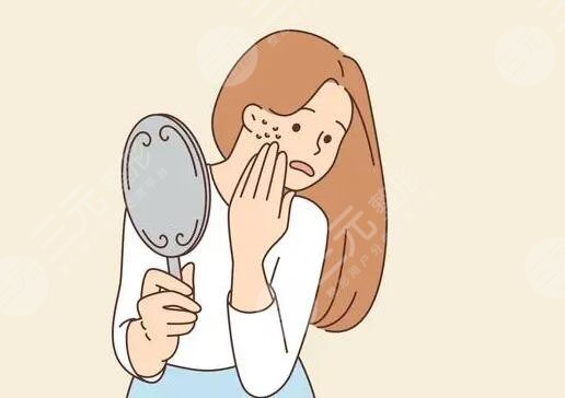 激光緩解痤瘡有副作用嗎?