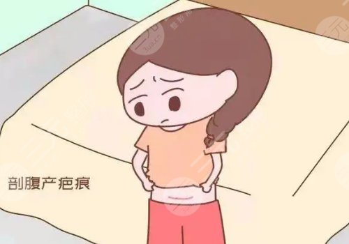 激光去疤痕需要幾次才能徹底消除？