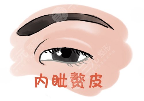 開內(nèi)眼角一般多少錢？