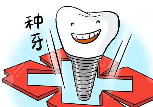 正常種一顆牙多少錢？