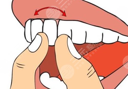 正常種一顆牙多少錢？