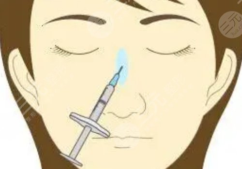 艾莉薇傳奇玻尿酸維持多久？