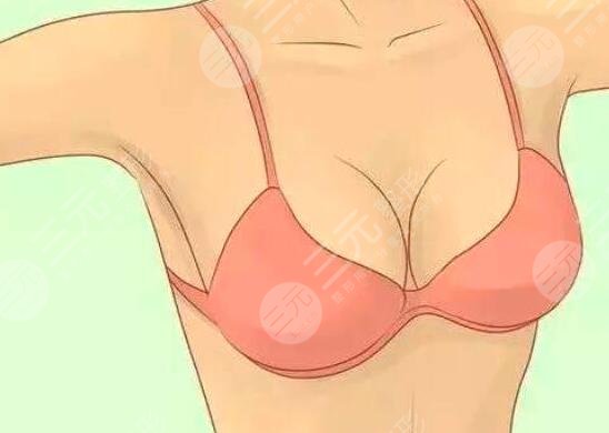 傲諾拉星熠多少錢2023？傲諾拉星熠適用人群和術(shù)后注意事項有哪些？