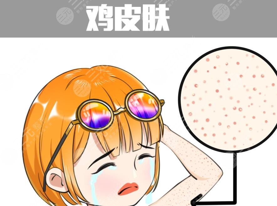 雞皮疙瘩皮膚怎么治見效快？預防和根治雙重入手，避免反復發(fā)作！