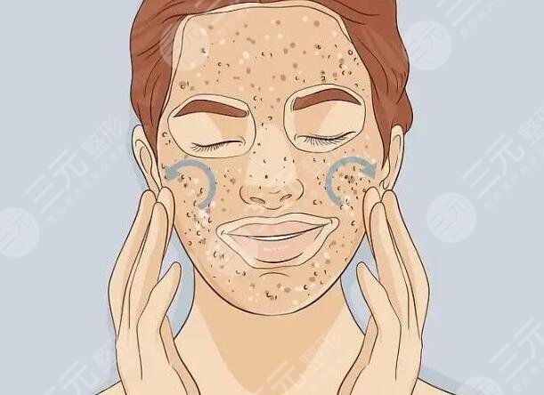 去角質(zhì)的注意事項——如何正確使用去角質(zhì)產(chǎn)品