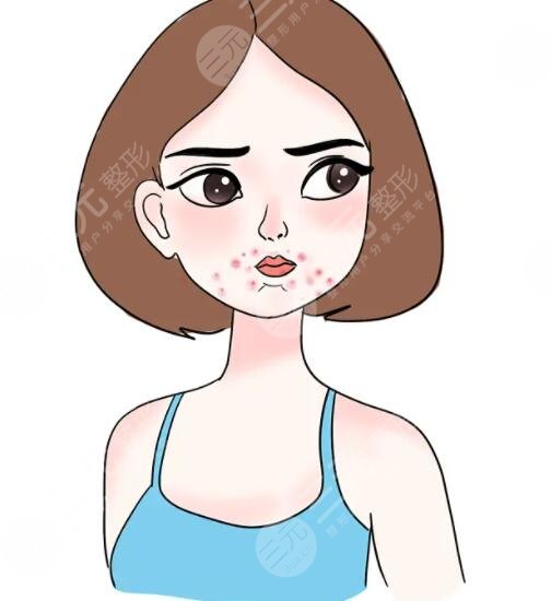 溫和去角質(zhì)