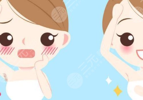 激光脫毛和冰點脫毛有什么區(qū)別？