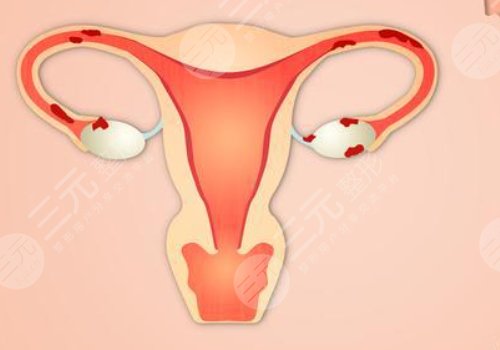 女性私處修復(fù)手術(shù)大概多少錢(qián)？