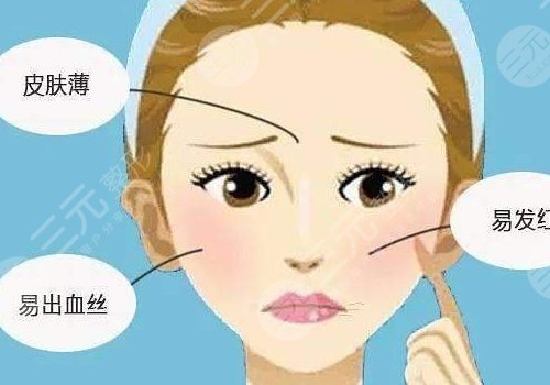 紅血絲皮膚用什么護(hù)膚品？3