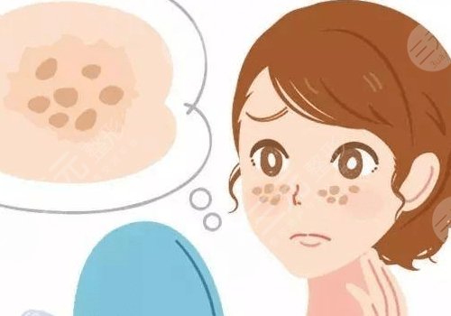 臉上長了色斑是什么原因造成的?