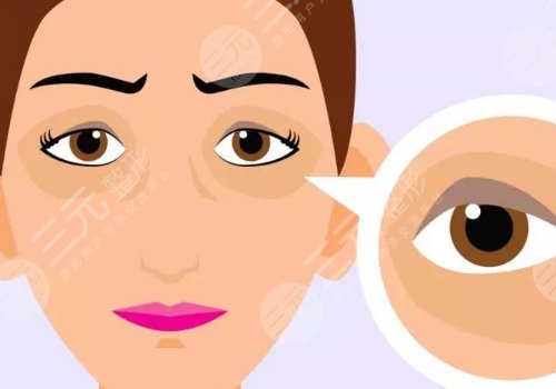 有了黑眼圈怎么消除？