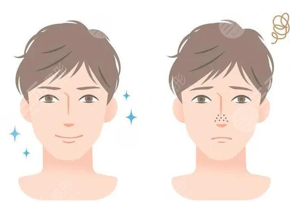 男士皮膚美白的方法和技巧有哪些？擁有健康男子氣概膚色~