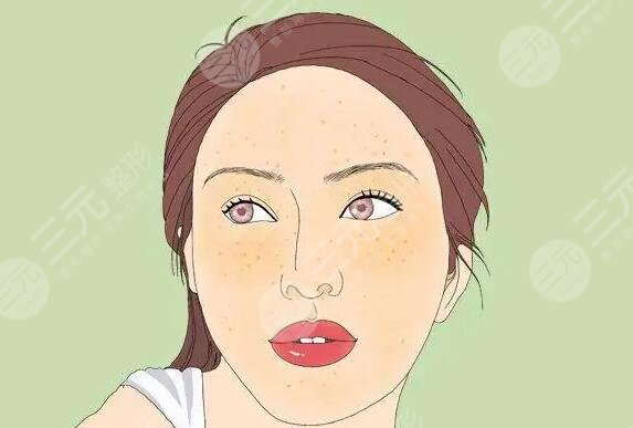 微針去除黃褐斑