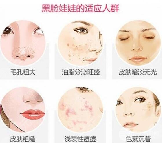 “黑臉娃娃”注意事項