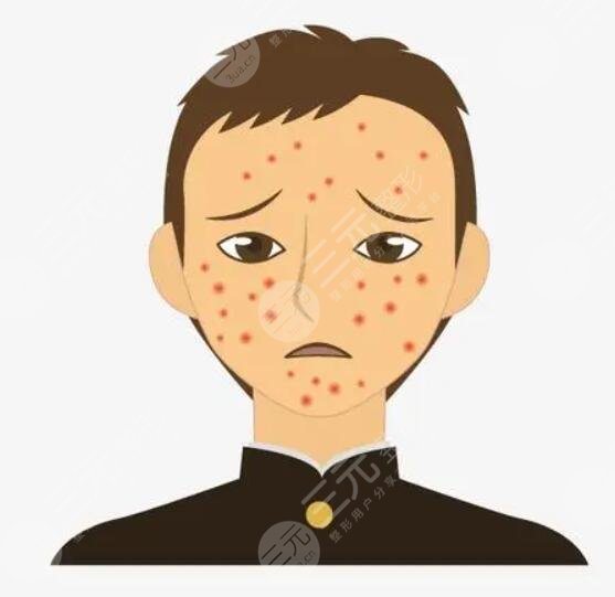 適當(dāng)?shù)倪\動和休息