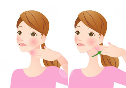 自體脂肪隆下巴多少錢？