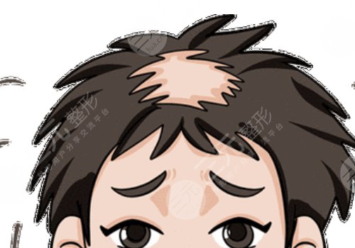 額頭頭發(fā)稀少怎么辦?