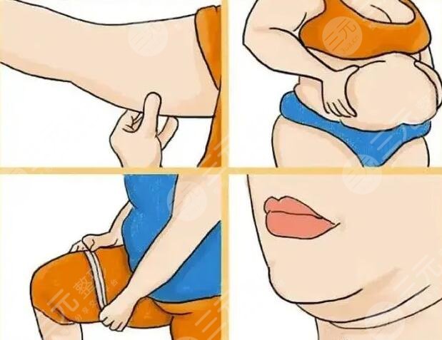 光纖溶脂的術(shù)后注意事項